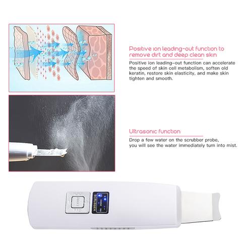 Limpiador facial ultrasónico para puntos negros y acné, masajeador vibratorio, máquina de limpieza ultrasónica 394