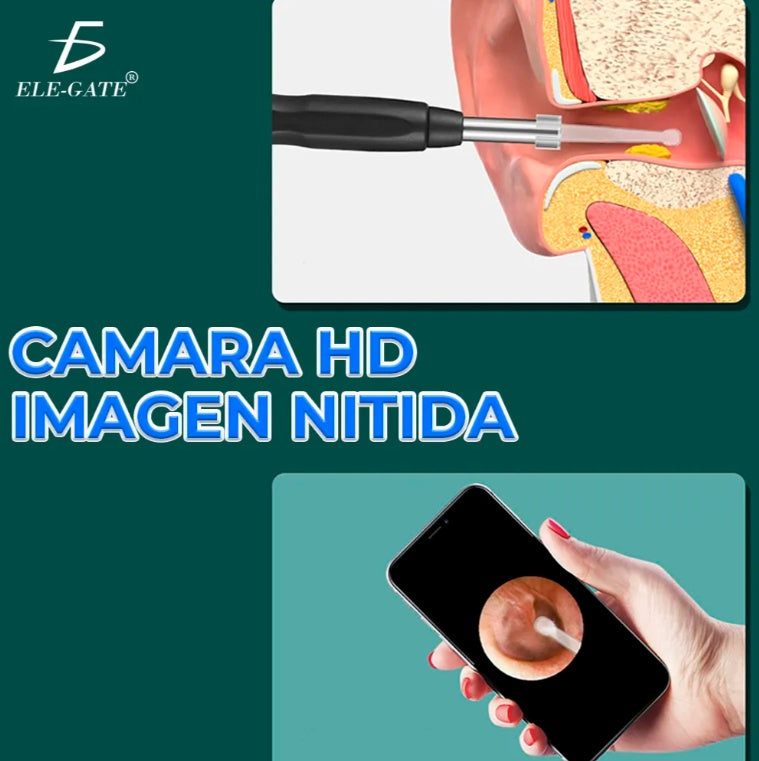 Limpiador de Oídos con Cámara HD y Wi-Fi | Limpieza Segura y Precisa