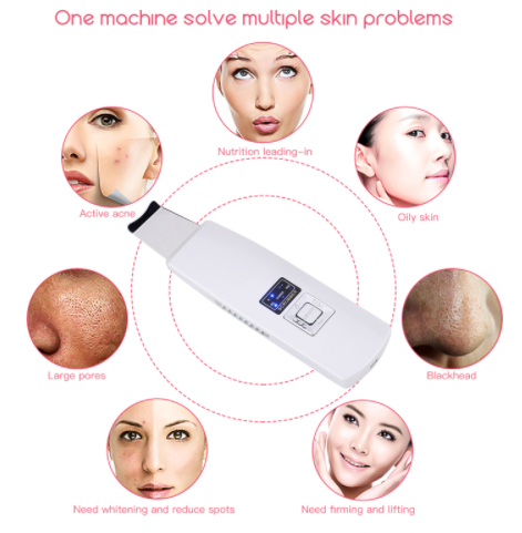 Limpiador facial ultrasónico para puntos negros y acné, masajeador vibratorio, máquina de limpieza ultrasónica 394