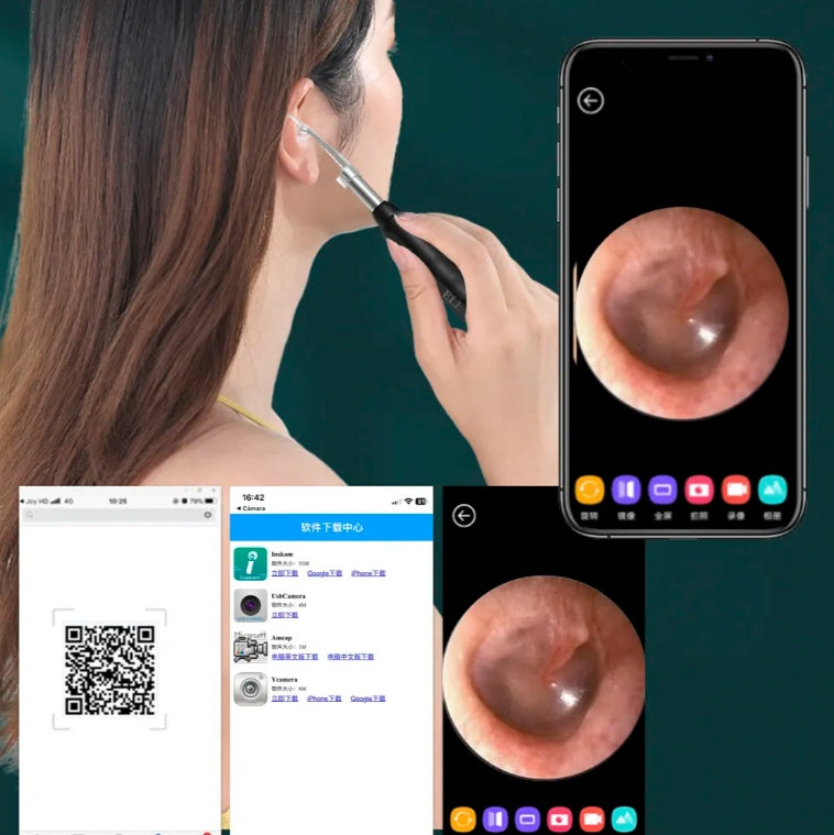 Limpiador de Oídos con Cámara HD y Wi-Fi | Limpieza Segura y Precisa