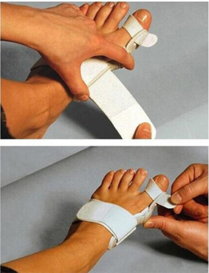 Corrector de juanete (Hallux Valgus), separador de dedo del pie, uso terapéutico