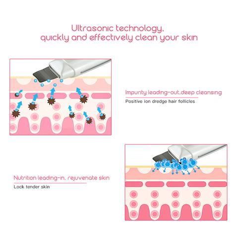 Limpiador facial ultrasónico para puntos negros y acné, masajeador vibratorio, máquina de limpieza ultrasónica 394