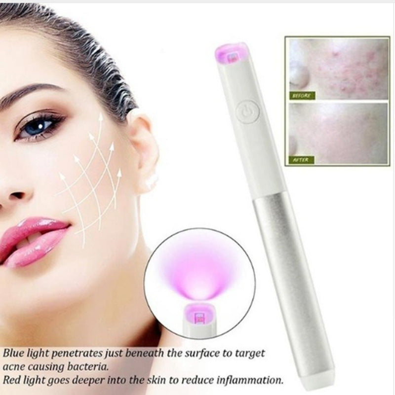 Instrumento de belleza para acné, lápiz para corrección de secuelas de la viruela con luz roja y azul.