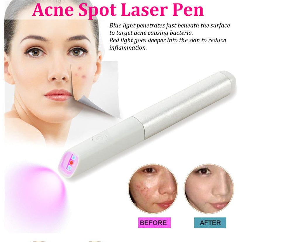 Instrumento de belleza para acné, lápiz para corrección de secuelas de la viruela con luz roja y azul.